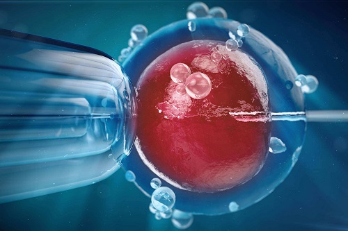 试管婴儿IVF自然周期适合哪些人群？